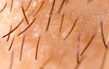 Bristles on the beard of a man