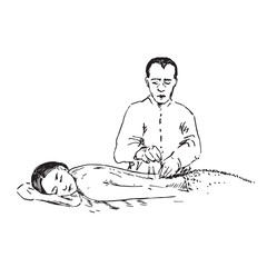 Doctor insert acupuncture needles in laying woman`s back, hand drawn doodle, sketch in pop art style, black and white medical vector illustration