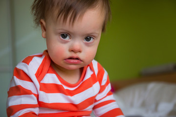 Portrait of cute baby boy with Down syndrome on the bed in home bedroom