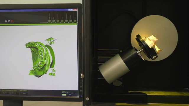 medical laboratory, modern dantist apparatus scans artificial jaw in lighting and shows on computer monitor