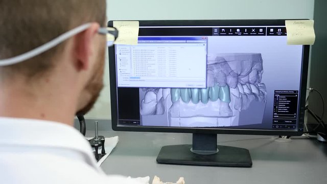Modern dentistry, Orthodontist makes 3D-model of jaw on computer at job close-up