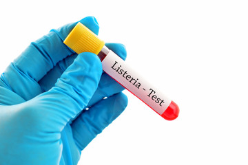 Obraz premium Test tube with blood sample for Listeria bacteria test, diagnosis for Listeriosis 