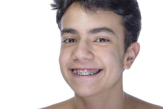 Teen boy wearing braces on white background