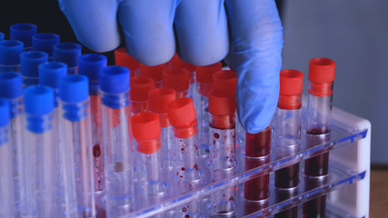 Lab work, a man holds test tubes in blue rubber gloves, analysis, dna, a test tube stand.