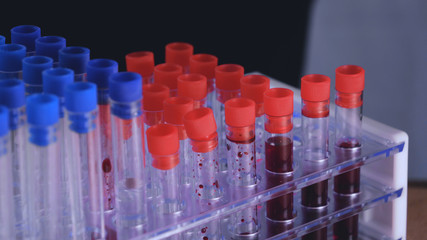 Ampoules (Test tubes) in the ampoule holder