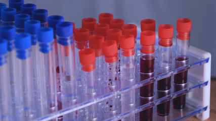 Ampoules (Test tubes) in the ampoule holder