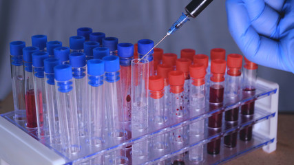 Lab work, a man holds a syringe, takes an analysis from a test tube in blue rubber gloves, analysis, blood, DNA, a test tube stand.