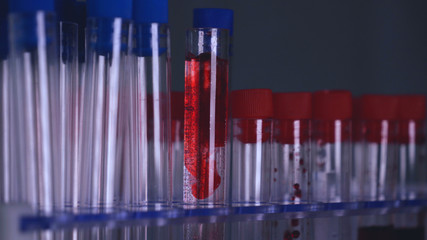 Ampoules (Test tubes) in the ampoule holder