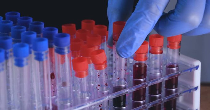 Lab work, a man holds test tubes in blue rubber gloves, analysis, dna, a test tube stand.