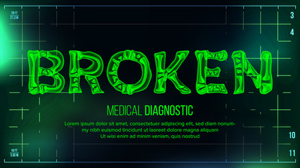Broken Banner Vector. Medical Background. Transparent Roentgen X-Ray Text With Bones. Radiology 3D Scan. Medical Health Typography. Futuristic Technology Illustration