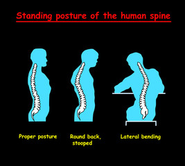 Standing posture of the blue human spine. Defects of the human spine. Correct alignment of human body in standing posture. vector illustration