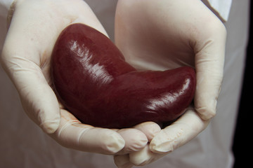 Underground kidney transplant surgery concept. illegal organ transplantation. human kidney is in...