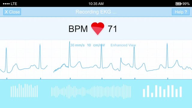 A simulated animation of an EKG recording. For use as playback on a screen.

