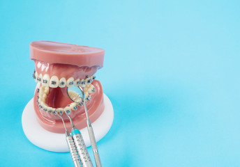 orthodontic model and dentist tool - demonstration teeth model of varities of orthodontic bracket...