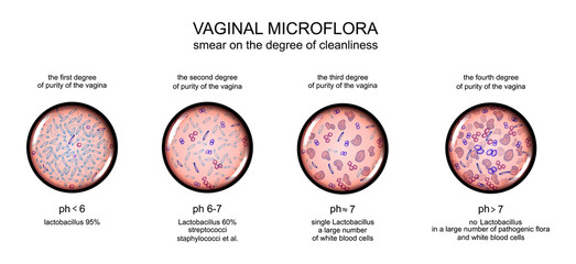 vaginal microflora. degree of purity of the vagina