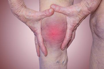 Senior woman holding the knee with pain
