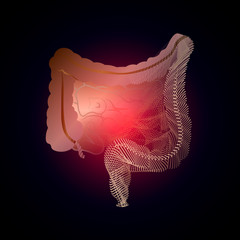 Intestine with a point of pain. Stylized transition from a real organ to an X-ray effect. Medical illustration of intestinal diseases