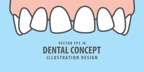 Banner Upper askew teeth illustration vector on blue background. Dental concept.