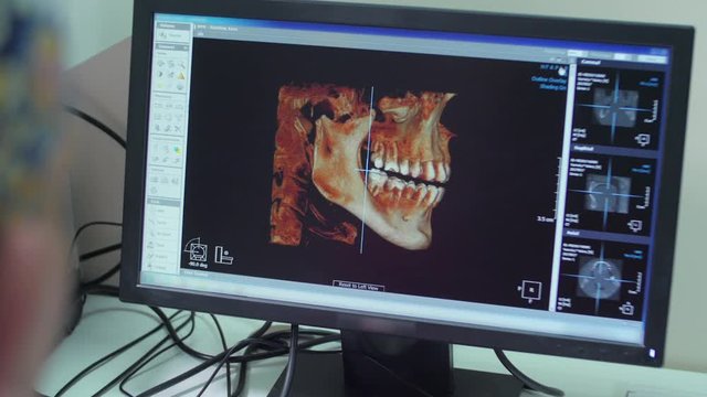 Photos of an oral cavity