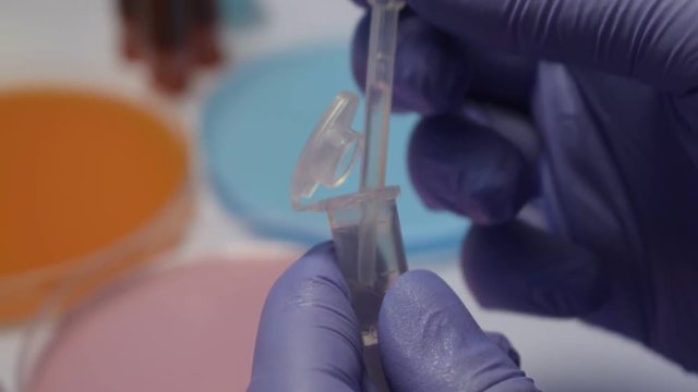 stem cell immunotherapy research researcher doctor laboratory technician using petri dish and colorful substances