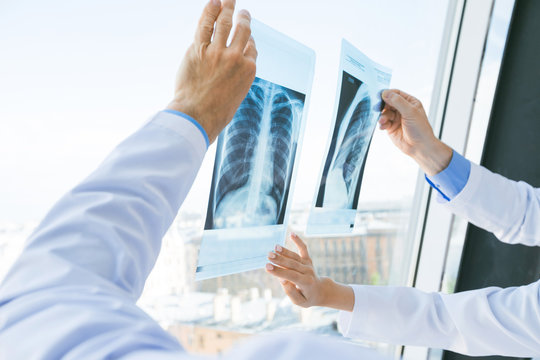 Doctors discuss x-ray