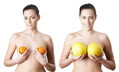 Woman Holding Satsumas And Melons To Illustrate Breast Enlargement Surgery - obrazy, fototapety, plakaty