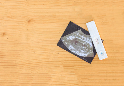 ultrasound with pregnancy test on wooden background