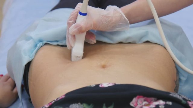 Female doctor examining woman using an ultrasound scanner.