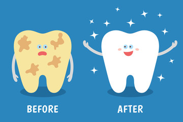 Cartoon tooth before and after cleaning or whitening or dental procedures. Dental illustration for kids. Comparison concept. Dirty and clean teeth. Flat style.