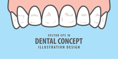 Banner Upper White spots on teeth illustration vector on blue background. Dental concept.