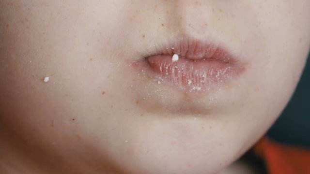 Mouth of freckled teenager boy eating large sweet marshmallows. Problem of eating sugar, diabetes mellitus