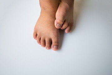 Both feet and toes stand on a white background.