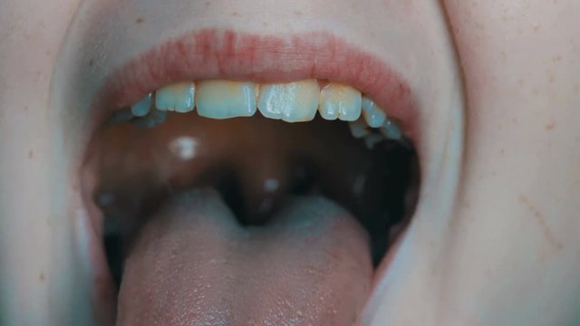 Teenager boy opens his mouth