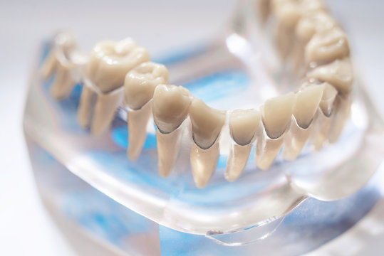 Dental model and dental equipment on white background, concept medical image of dental healtcare, dental hygiene