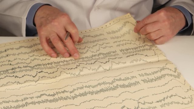Doctor neurologist studies electroencephalogram and makes notes