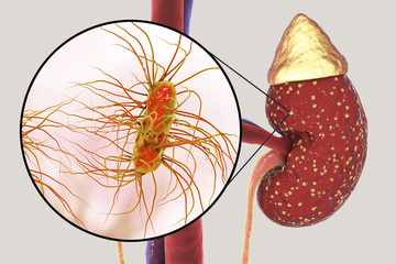 Pyelonephritis, medical concept, and close-up view of bacteria Escherichia coli, the common causative agent of kidney infection, 3D illustration