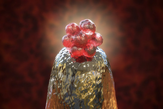 16-cell human embryo on a needle tip, 3D illustration