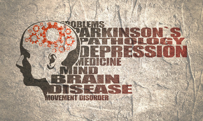 Abstract illustration of a human head. Woman face silhouette. Medical theme creative concept. Parkinsons syndrome disease tags cloud. Damaged gears in brain as symbol of mental disease