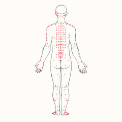 Body (back) acupuncture scheme with red points, hand drawn doodle, sketch in pop art style, black and white medical vector illustration