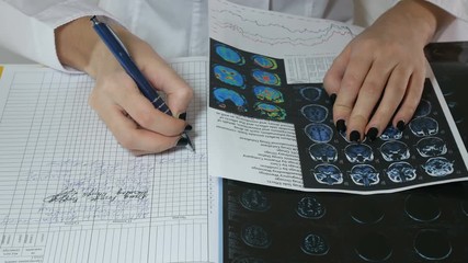 The doctor works in a modern private hospital. He looks at the x-ray of the patient in the medical office. - Powered by Adobe