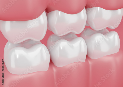 “Dentes, arcada dentária, renderização 3D” Stock photo and royalty-free