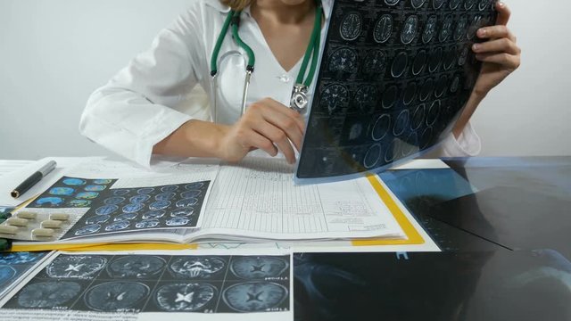 Female doctor is studying x-rays