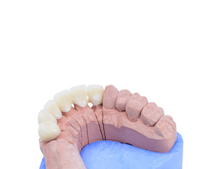 Close up denture ceramic model on white background