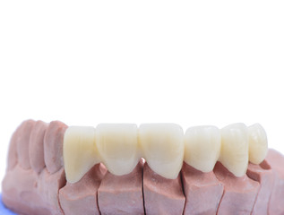 Close up dental model on white background