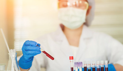 Female Technician holding blood tube test, a rack of  blood samples Tubes of patients in laboratory in the hospital.
