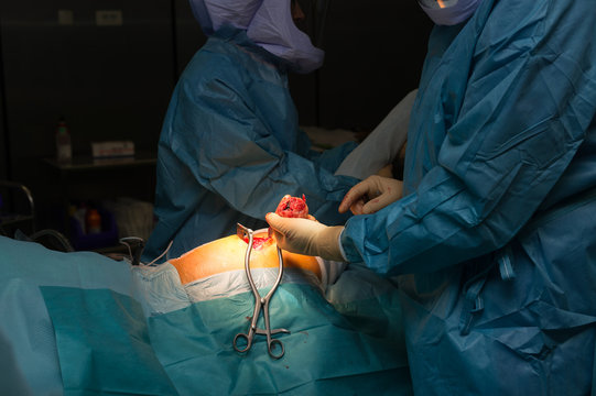 HIP PROSTHESIS SURGERY