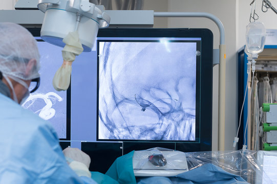 INTERVENTIONAL NEURORADIOLOGY