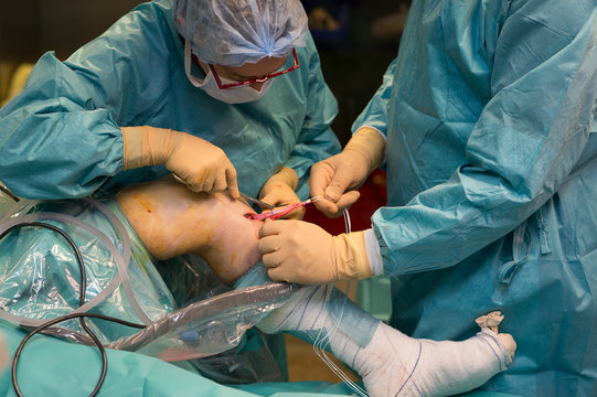 LIGAMENT SURGERY