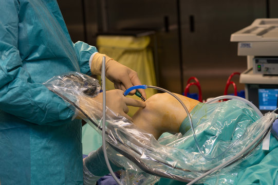 LIGAMENT SURGERY