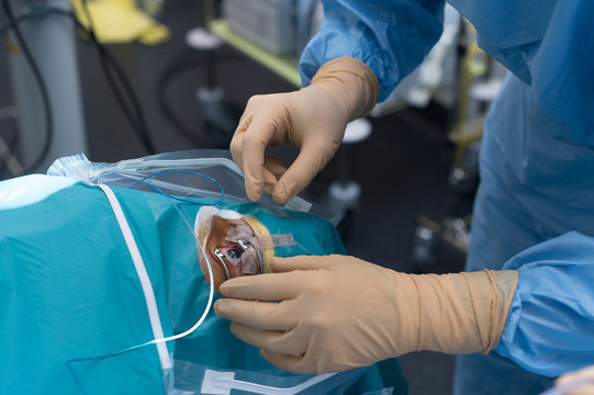 RETINAL DETACHMENT SURGERY